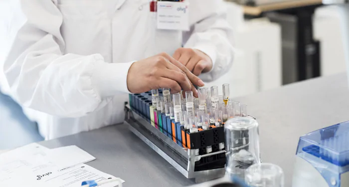Laboratorium sample-verwerking
