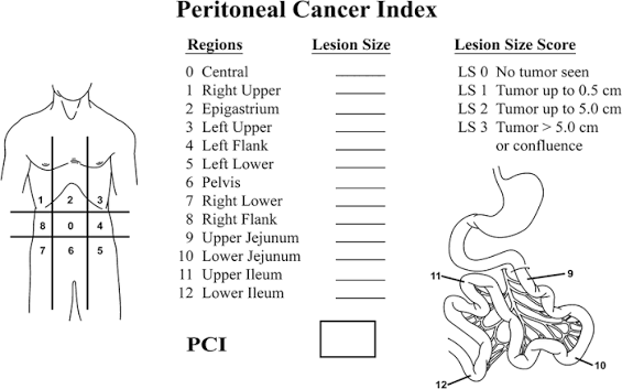 Peritoneal Cancer Index (PCI) scoreformulier